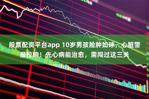 股票配资平台app 10岁男孩脸肿如球，心脏警报拉响！先心病能治愈，需闯过这三关